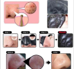 Blackhead Remover Cleansing Gel Mask